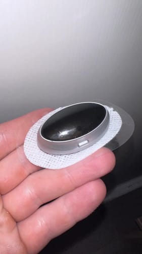 Customer photo review of SleepEase Pro — Eliminates Snoring & Sleep Apnea